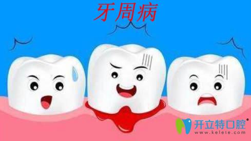 牙周病是什么？治療牙周病的方法和臨床效果分析