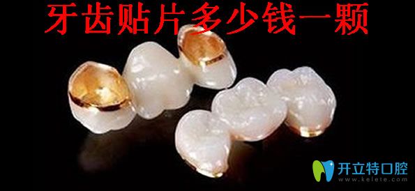 牙齒貼面多少錢(qián)一顆