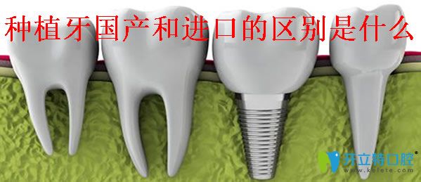 種植一顆牙價格是多少 種植牙是國產(chǎn)好還是進(jìn)口好區(qū)別在哪
