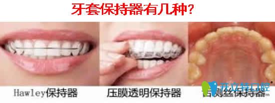 解惑：隱形牙套保持器多少錢(qián) 牙套保持器要帶多長(zhǎng)時(shí)間