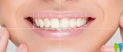 DSD微笑美學(xué)設(shè)計(jì) 