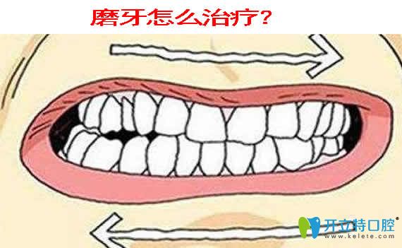 磨牙怎么治療
