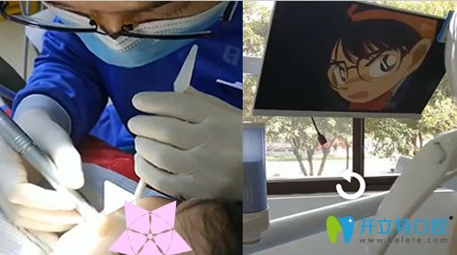 去昆明瑾帆口腔給孩子補(bǔ)牙