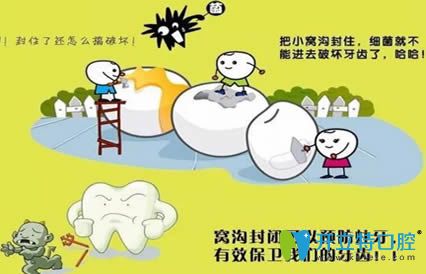 開立特口腔網(wǎng)兒童窩溝封閉的好處及時間