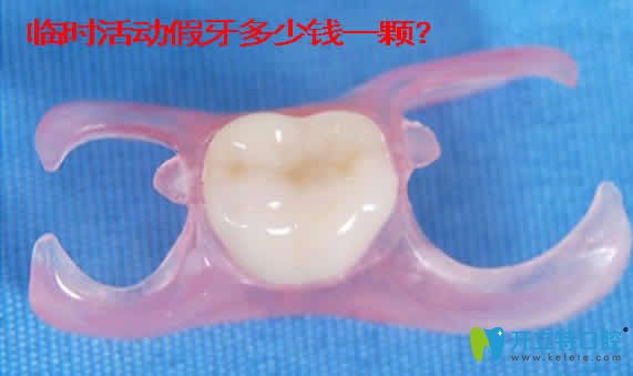 臨時(shí)活動(dòng)假牙價(jià)格