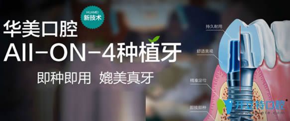 貴陽華美牙科種植牙及正畸技術優(yōu)勢