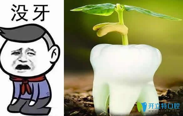 老人能不能做種植牙