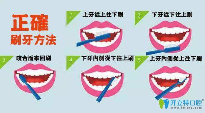 預(yù)防牙周病首先得掌握正確的刷牙方法