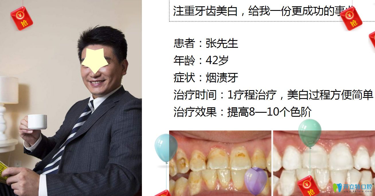 深圳牙齒美白哪里做？格倫菲爾口腔皓齒美白案例公布