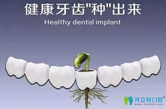 種植牙和真牙的壽命一樣嗎