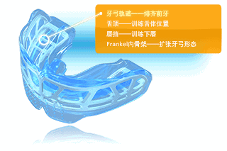 MRCA肌功能矯正器