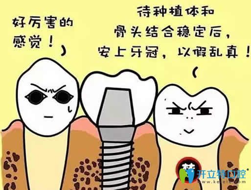 種植牙會導(dǎo)致鄰牙松動嗎