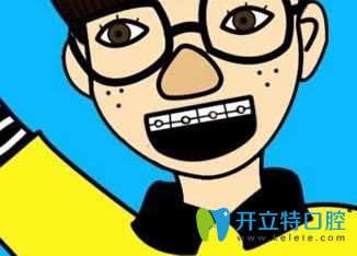 國外正畸不拔牙的真實原因