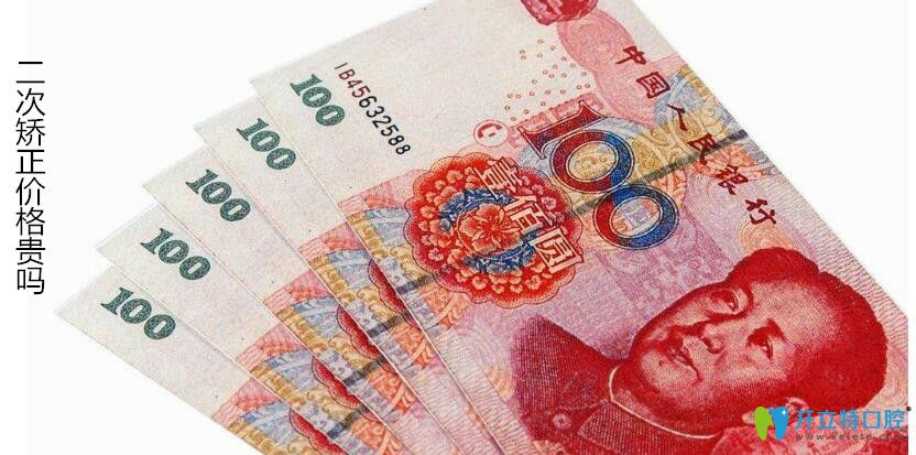 牙齒二次矯正會(huì)貴些嗎