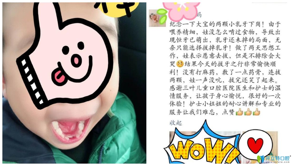 孩子在三葉進(jìn)行治療后家長(zhǎng)點(diǎn)評(píng) 孩子在三葉進(jìn)行治療后家長(zhǎng)點(diǎn)評(píng)