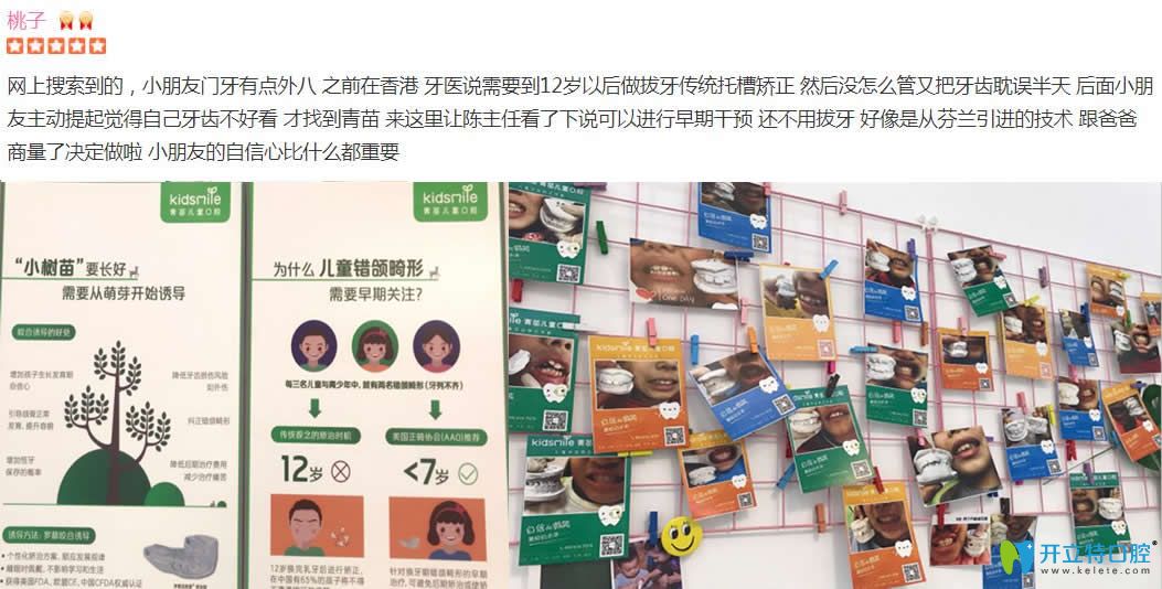 <!--<i data=20240703-sp></i>-->兒童口腔好不好？呈上近期顧客看牙評價