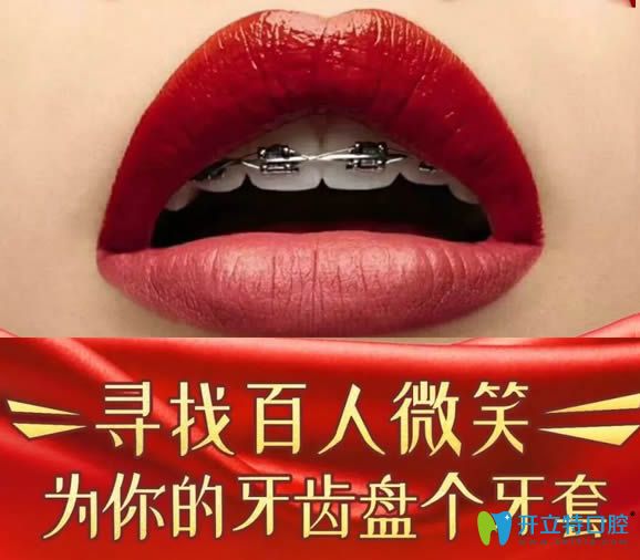 鄭州拜博口腔尋找百人微笑為您的牙齒盤個(gè)牙套