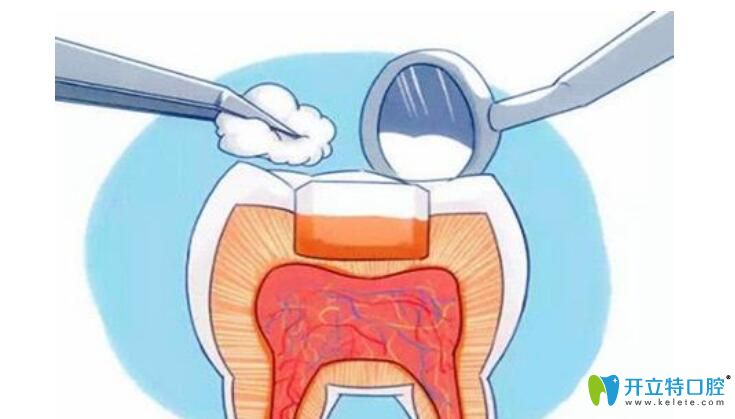 兒童補(bǔ)牙疼嗎