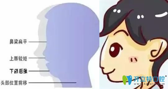 今日分享習慣性口腔呼吸有什么危害及用嘴巴呼吸怎么改正