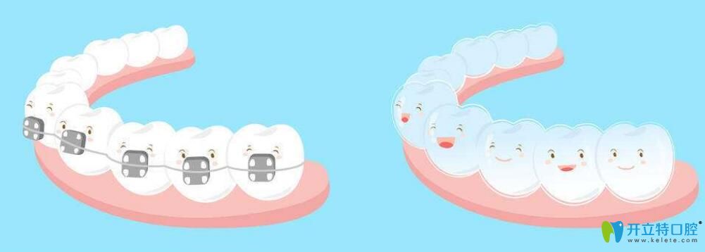 正頜和正畸手術(shù)的區(qū)別？正頜手術(shù)哪里做得好,費(fèi)用是多少？