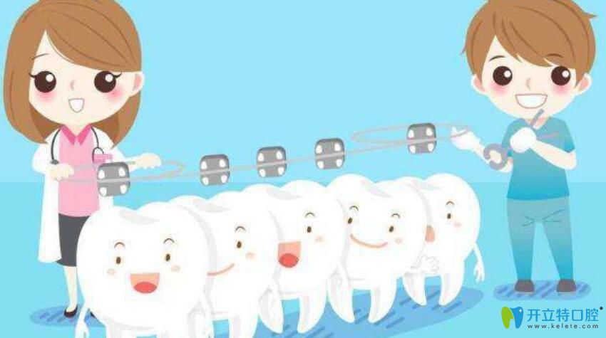 矯牙為什么那么貴？資深牙醫(yī)告訴你不知道的正牙價(jià)格內(nèi)幕