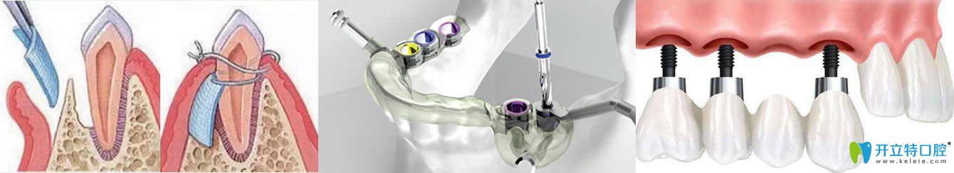 廣東圣貝孫世堯三大種植技術(shù)