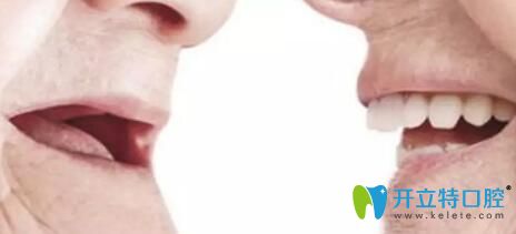 北京中諾口腔張勝民全口義齒修復(fù)案例