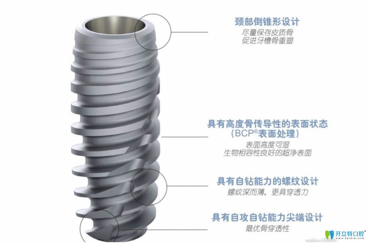 法國安卓健種植體優(yōu)勢(shì)