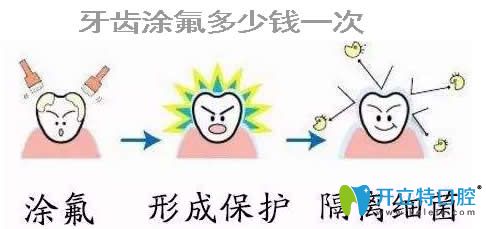 專業(yè)解答：小孩牙齒涂氟多少錢(qián)以及涂氟防齲有沒(méi)有副作用