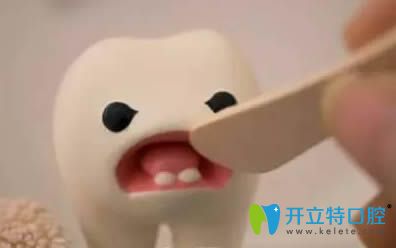 活髓切斷術(shù)是根管治療嗎