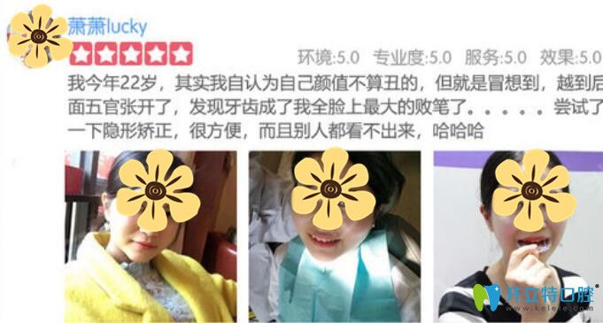 顧客在美奧做隱形矯正牙齒體驗后反饋評價