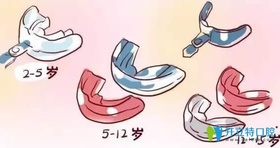 小孩使用的專業(yè)口呼吸矯正器圖