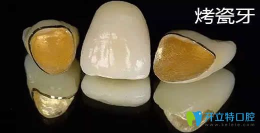 烤瓷牙崩瓷有沒有毒