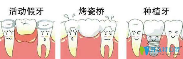 根管治療好還是拔牙好