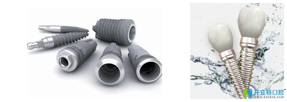 美國3i種植牙系統(tǒng)