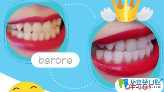 南京博韻口腔丁冬梅怎么樣？案例驗(yàn)證實(shí)力