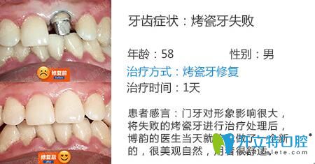 醫(yī)生姓名：周光正   醫(yī)生資質(zhì)：全科醫(yī)生  所屬機(jī)構(gòu)：南京博韻口腔  社會任職：  畢業(yè)院校：畢業(yè)于邢臺<!--<i data=20240703-sp></i>-->口腔醫(yī)學(xué)系  主診項(xiàng)目：牙列缺損修復(fù)、口腔種植、前牙美學(xué)修復(fù)、嵌體修復(fù)及復(fù)雜牙拔除。