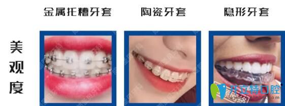 半隱形陶瓷牙套和金屬牙套隱形牙套對比優(yōu)勢