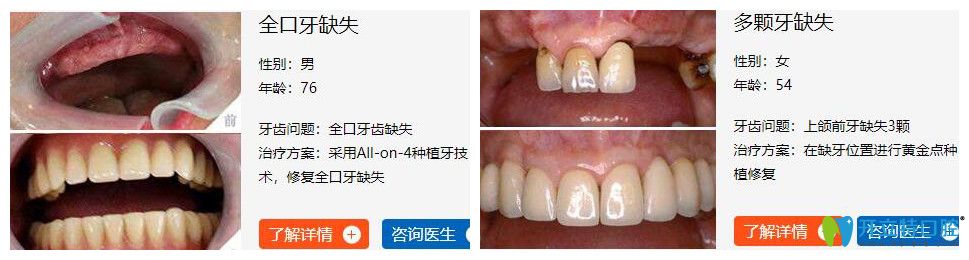 海濤口腔種植牙怎么樣？<span style=