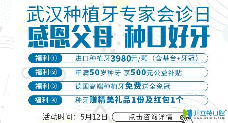 五一清華陽光口腔的種植牙價(jià)格也很讓人心動(dòng)