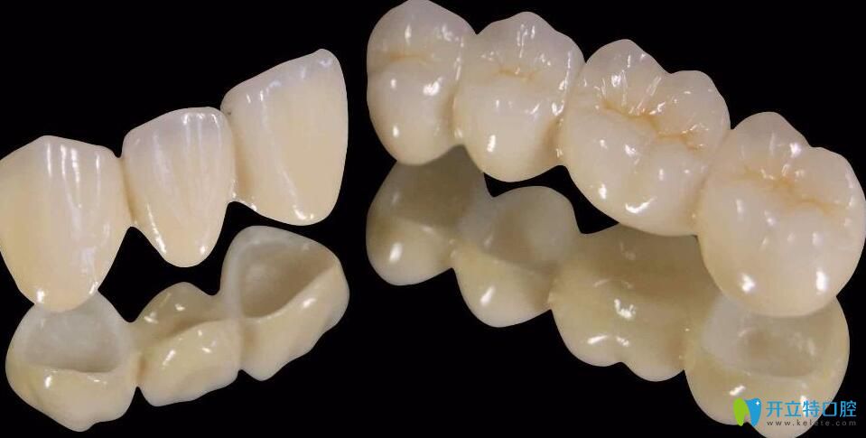 李杰醫(yī)生給大家解說：全瓷牙能用一輩子嗎
