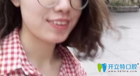 齙牙矯正前正面照