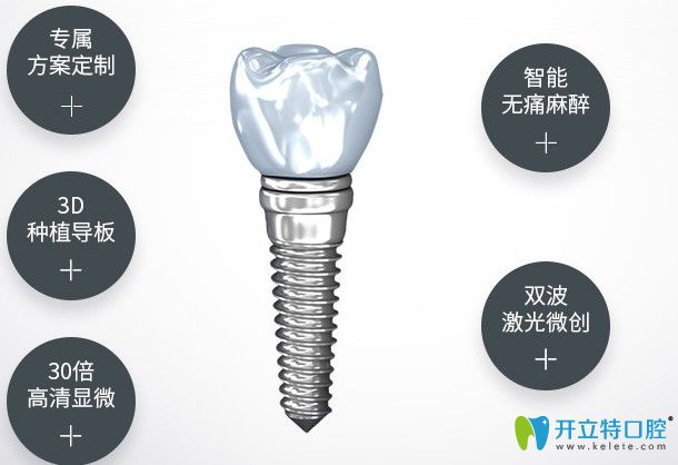 杭州美奧口腔種植牙優(yōu)勢