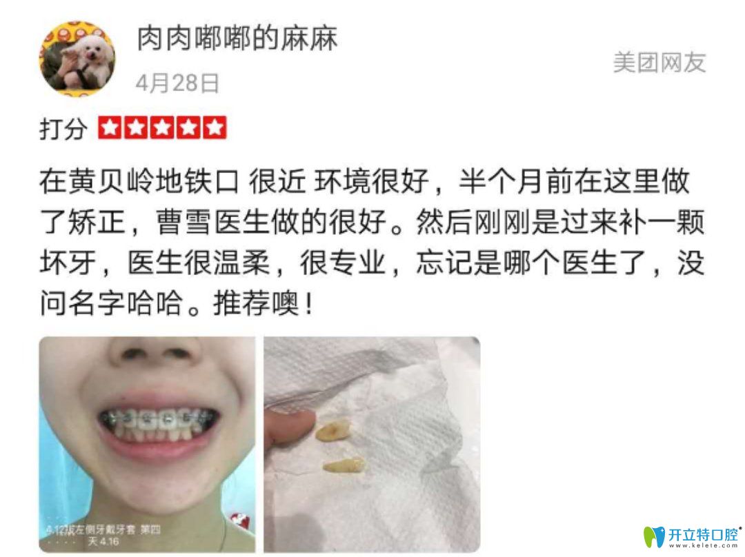 諾德齒科正畸真實(shí)反饋