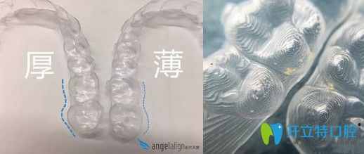 時代天使隱形牙套細節(jié)圖