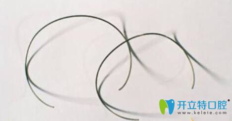 正畸搖椅弓，你所關(guān)心的問題都在這里