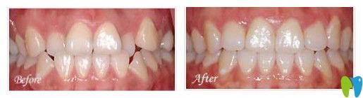 致美口腔時代天使矯正