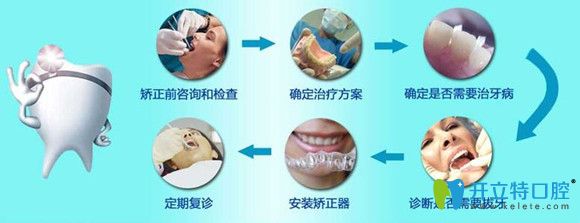 正畸知識(shí)分享：牙齒矯正詳細(xì)步驟和過(guò)程圖解