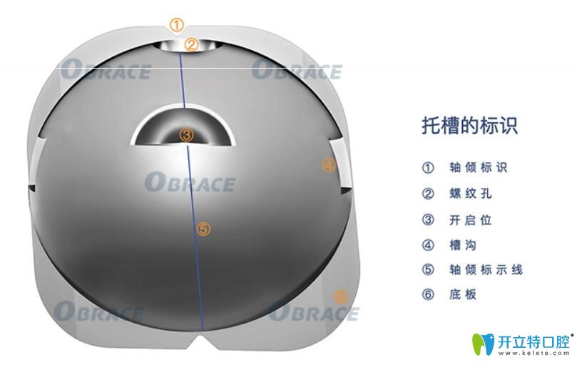 為什么要選擇obrace球面自鎖托槽矯正牙齒？答案在這里……