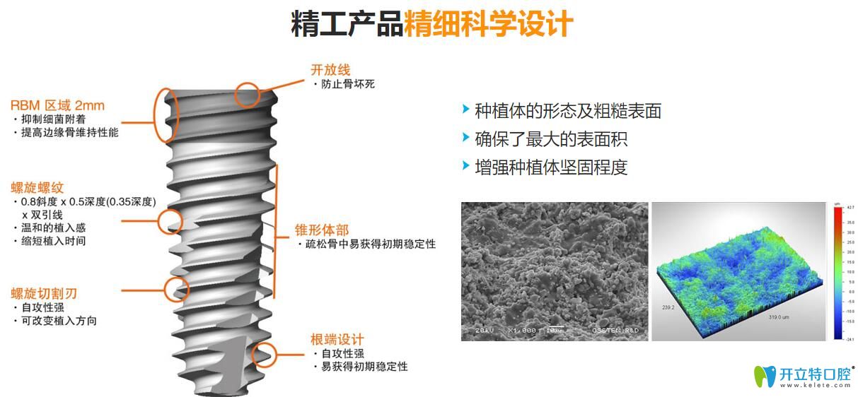 韓國(guó)種植牙質(zhì)量怎么樣？韓國(guó)種植體價(jià)格為什么比較便宜？